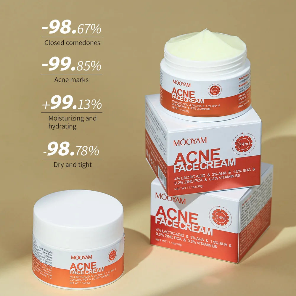 Acne Pimple Removal Cream