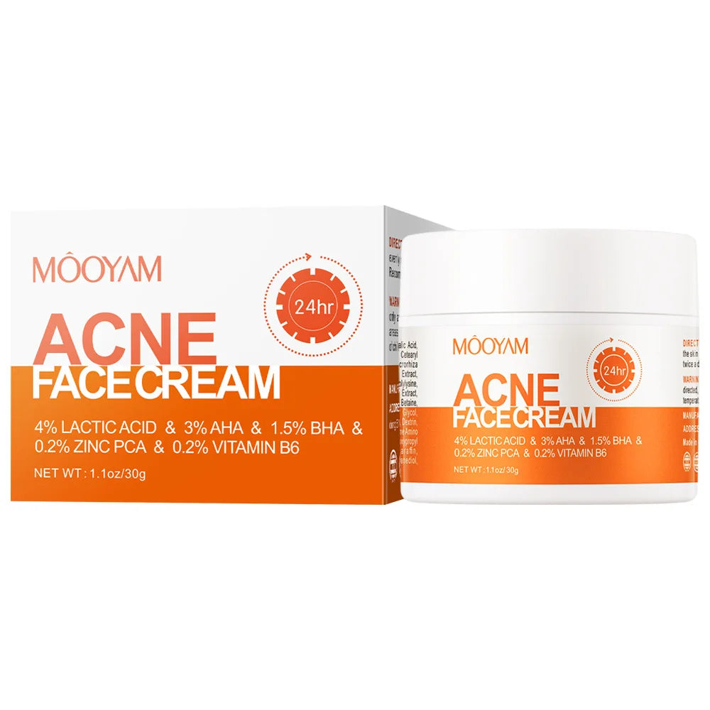 Acne Pimple Removal Cream