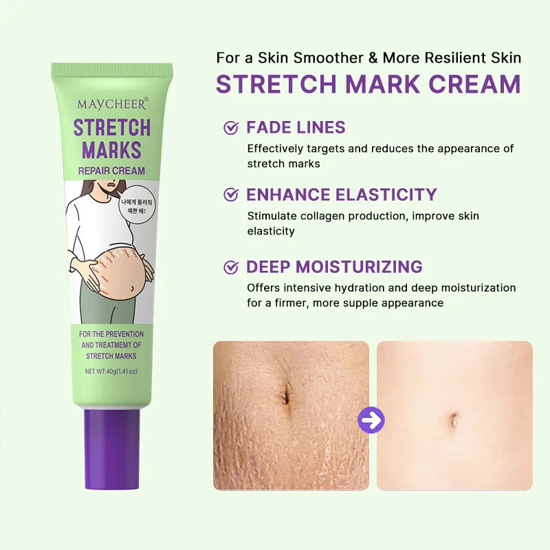 Stretch Marks Repair Cream