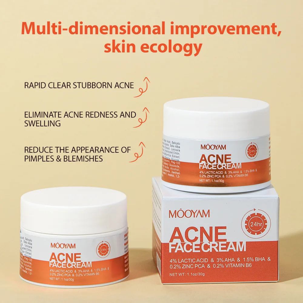 Acne Pimple Removal Cream